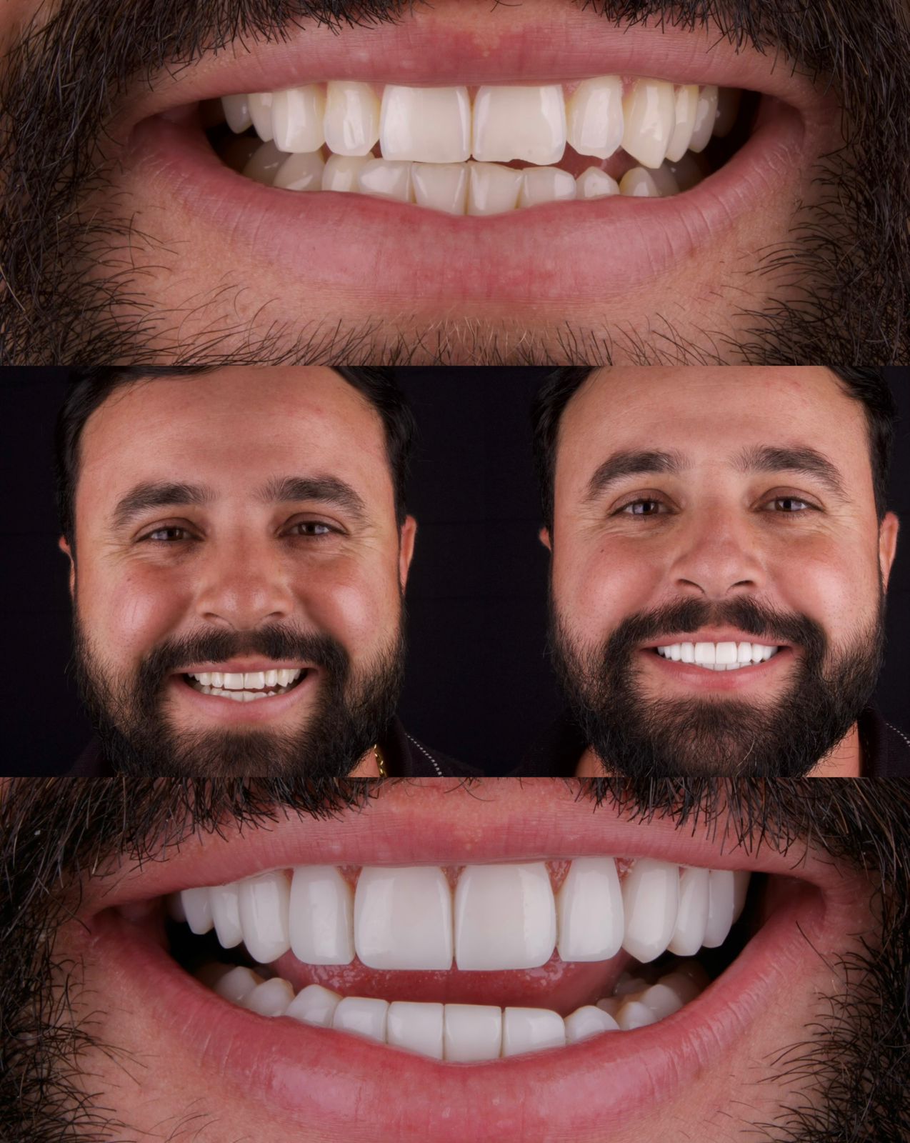 Caso de estética dental