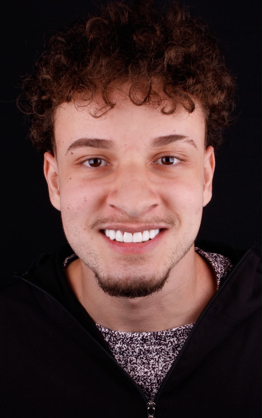 Resultado de estética dental com lentes em resina